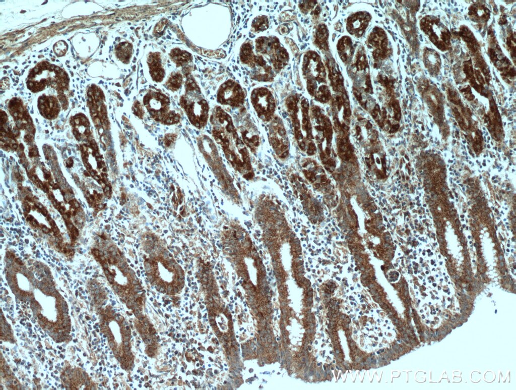 Immunohistochemistry (IHC) staining of human stomach tissue using DNAJC10 Polyclonal antibody (13101-1-AP)