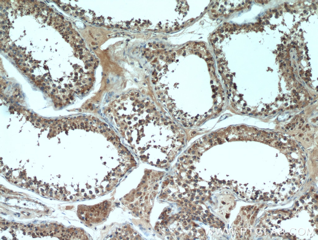 Immunohistochemistry (IHC) staining of human testis tissue using DNAJC10 Polyclonal antibody (13101-1-AP)