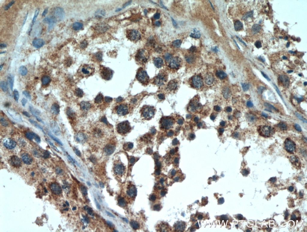 Immunohistochemistry (IHC) staining of human testis tissue using DNAJC10 Polyclonal antibody (13101-1-AP)