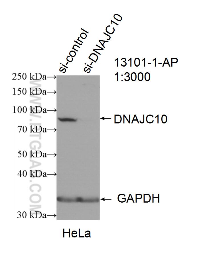 Western Blot (WB) analysis of HeLa cells using DNAJC10 Polyclonal antibody (13101-1-AP)