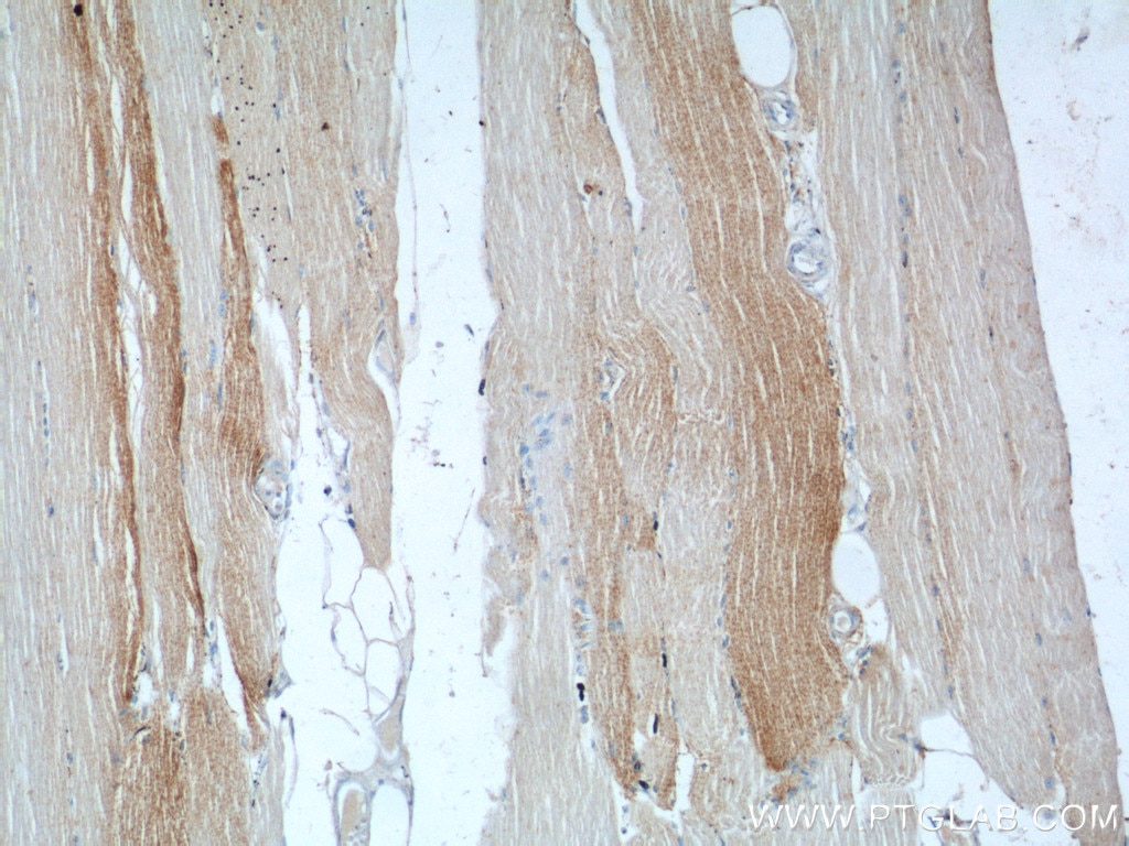 IHC staining of human skeletal muscle using 17331-1-AP