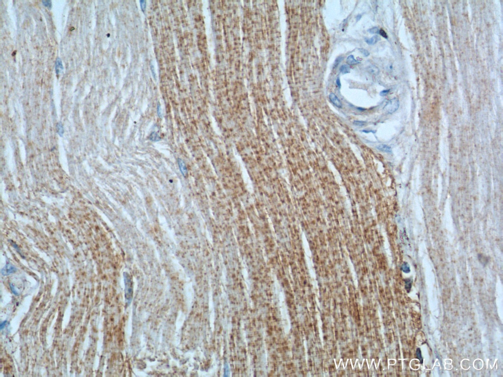 Immunohistochemistry (IHC) staining of human skeletal muscle tissue using DNAJC11 Polyclonal antibody (17331-1-AP)