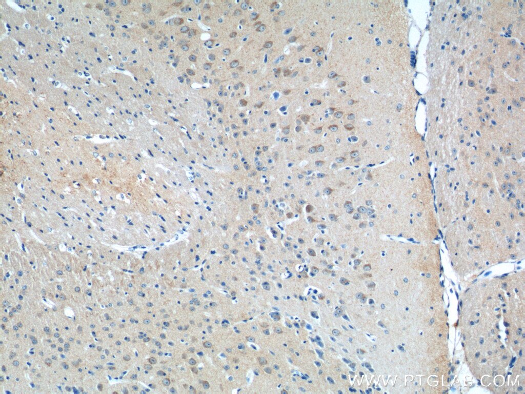 Immunohistochemistry (IHC) staining of mouse brain tissue using DNAJC11 Polyclonal antibody (17331-1-AP)