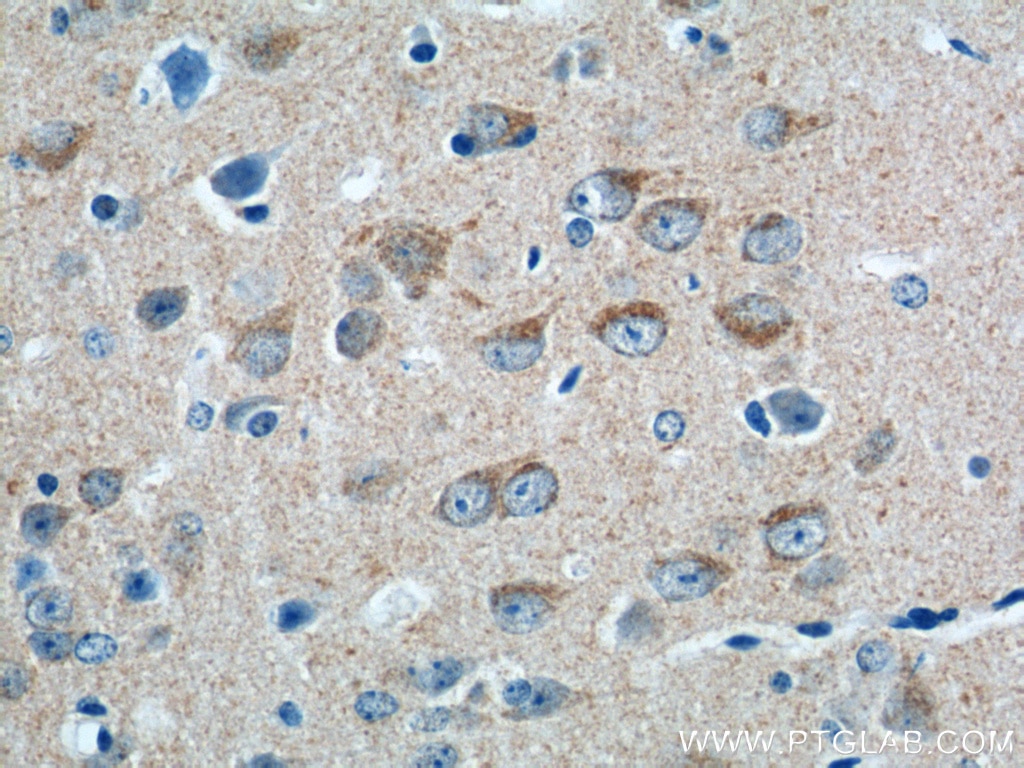 Immunohistochemistry (IHC) staining of mouse brain tissue using DNAJC11 Polyclonal antibody (17331-1-AP)