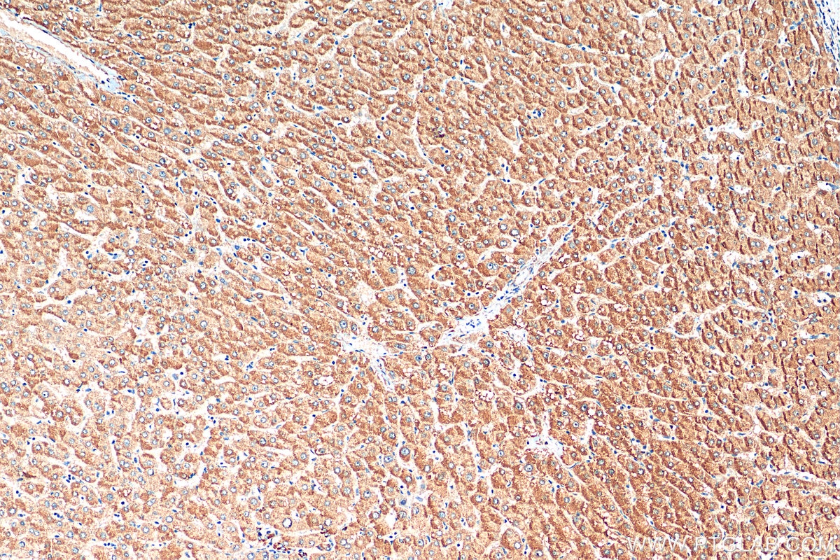Immunohistochemistry (IHC) staining of human liver tissue using DNAJC11 Polyclonal antibody (17331-1-AP)