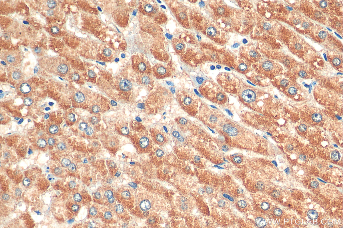 Immunohistochemistry (IHC) staining of human liver tissue using DNAJC11 Polyclonal antibody (17331-1-AP)