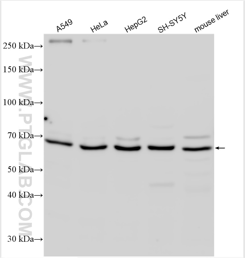 Western Blot (WB) analysis of various lysates using DNAJC11 Polyclonal antibody (17331-1-AP)