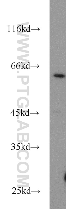 Western Blot (WB) analysis of HeLa cells using DNAJC11 Polyclonal antibody (17331-1-AP)
