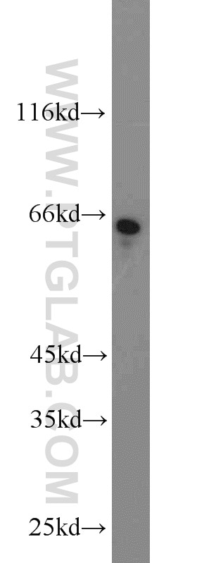 Western Blot (WB) analysis of SH-SY5Y cells using DNAJC11 Polyclonal antibody (17331-1-AP)
