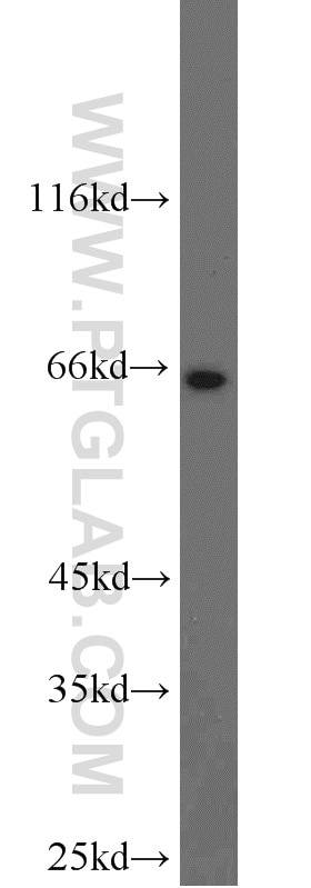 Western Blot (WB) analysis of HeLa cells using DNAJC11 Polyclonal antibody (17331-1-AP)