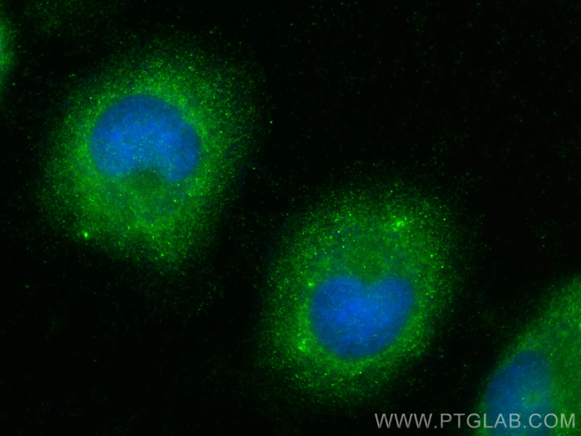 Immunofluorescence (IF) / fluorescent staining of HeLa cells using DNAJC13 Polyclonal antibody (31492-1-AP)
