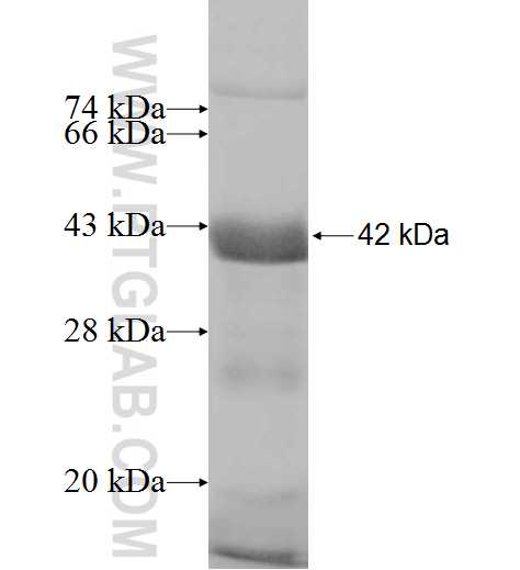 DNAJC14 fusion protein Ag7794 SDS-PAGE
