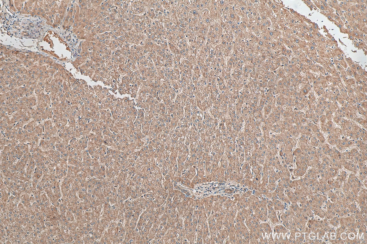 Immunohistochemistry (IHC) staining of human liver tissue using DNAJC15 Polyclonal antibody (16063-1-AP)