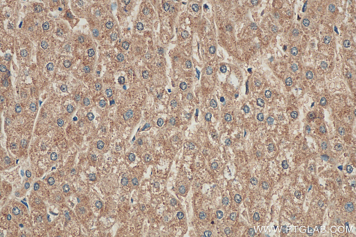 Immunohistochemistry (IHC) staining of human liver tissue using DNAJC15 Polyclonal antibody (16063-1-AP)