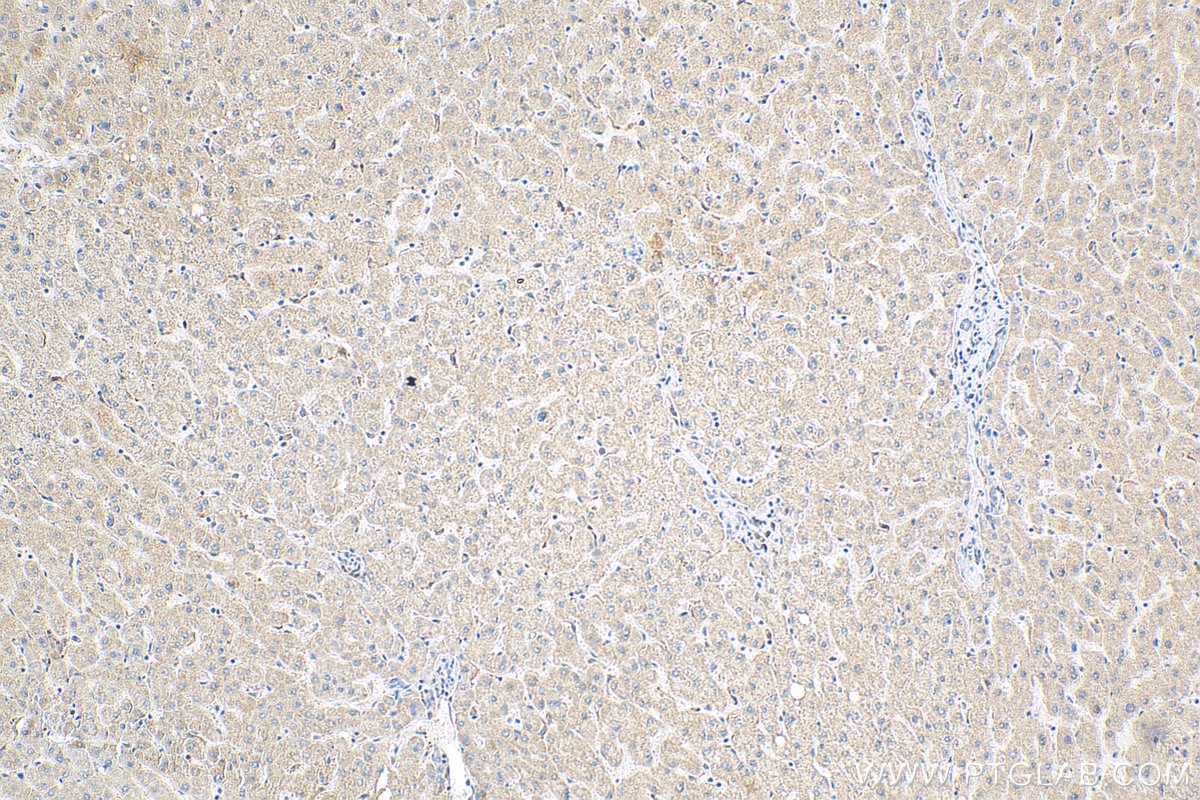 Immunohistochemistry (IHC) staining of human liver tissue using DNAJC15 Polyclonal antibody (16063-1-AP)