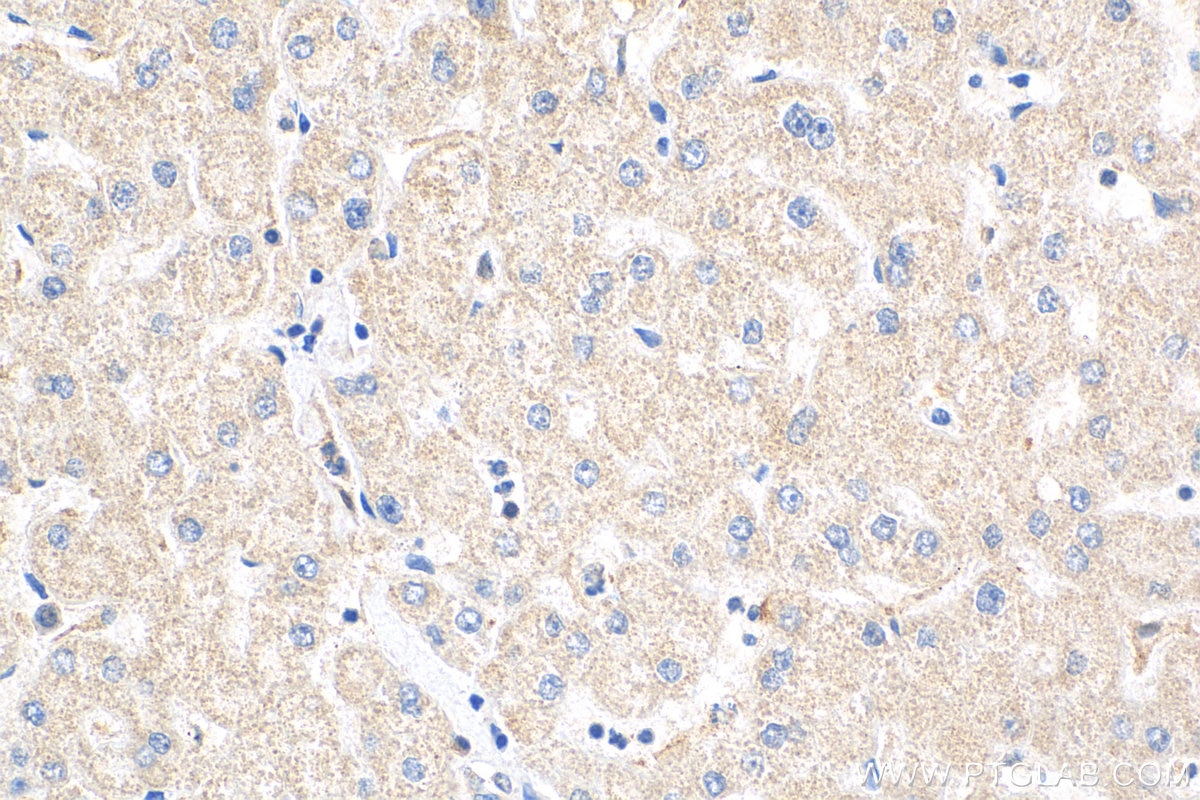 Immunohistochemistry (IHC) staining of human liver tissue using DNAJC15 Polyclonal antibody (16063-1-AP)