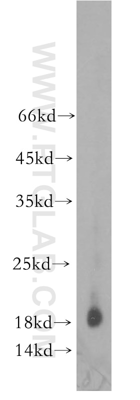 Western Blot (WB) analysis of human brain tissue using DNAJC15 Polyclonal antibody (16063-1-AP)