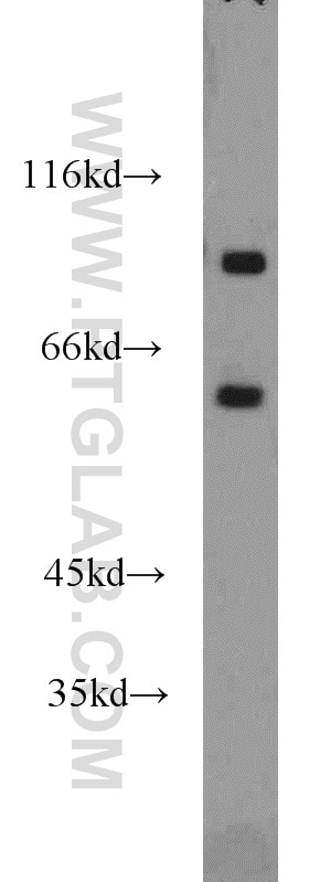 Western Blot (WB) analysis of mouse brain tissue using DNAJC16 Polyclonal antibody (17599-1-AP)