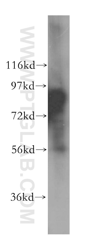 Western Blot (WB) analysis of mouse brain tissue using DNAJC16 Polyclonal antibody (17599-1-AP)