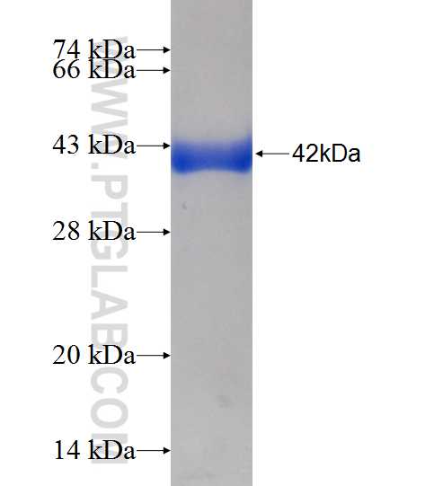 DNAJC16 fusion protein Ag11637 SDS-PAGE
