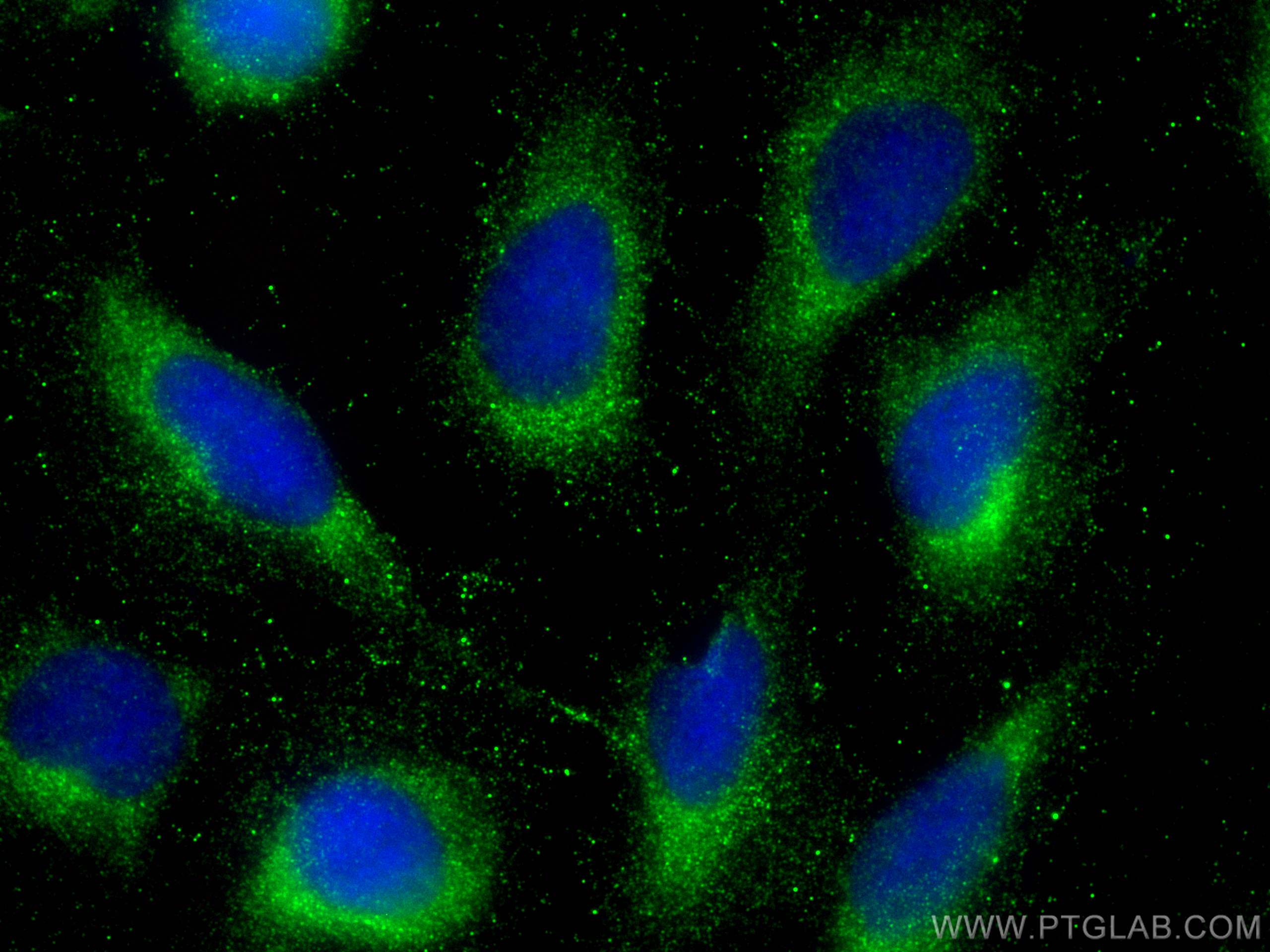 Immunofluorescence (IF) / fluorescent staining of U2OS cells using DNAJC18 Polyclonal antibody (25162-1-AP)