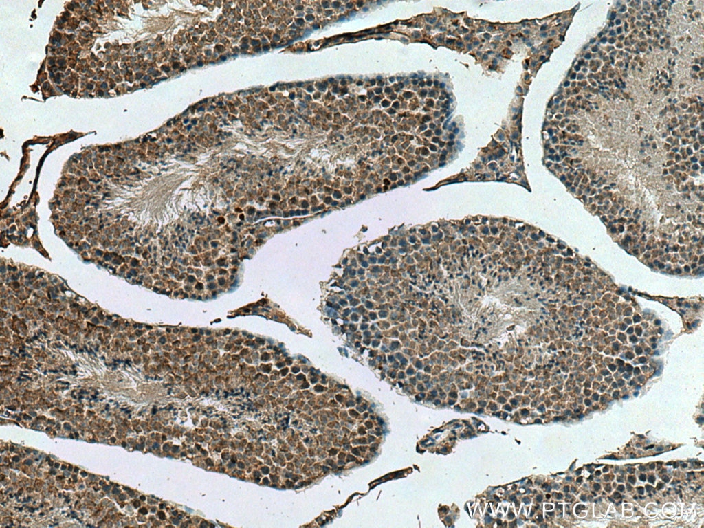 Immunohistochemistry (IHC) staining of mouse testis tissue using DNAJC18 Polyclonal antibody (25162-1-AP)