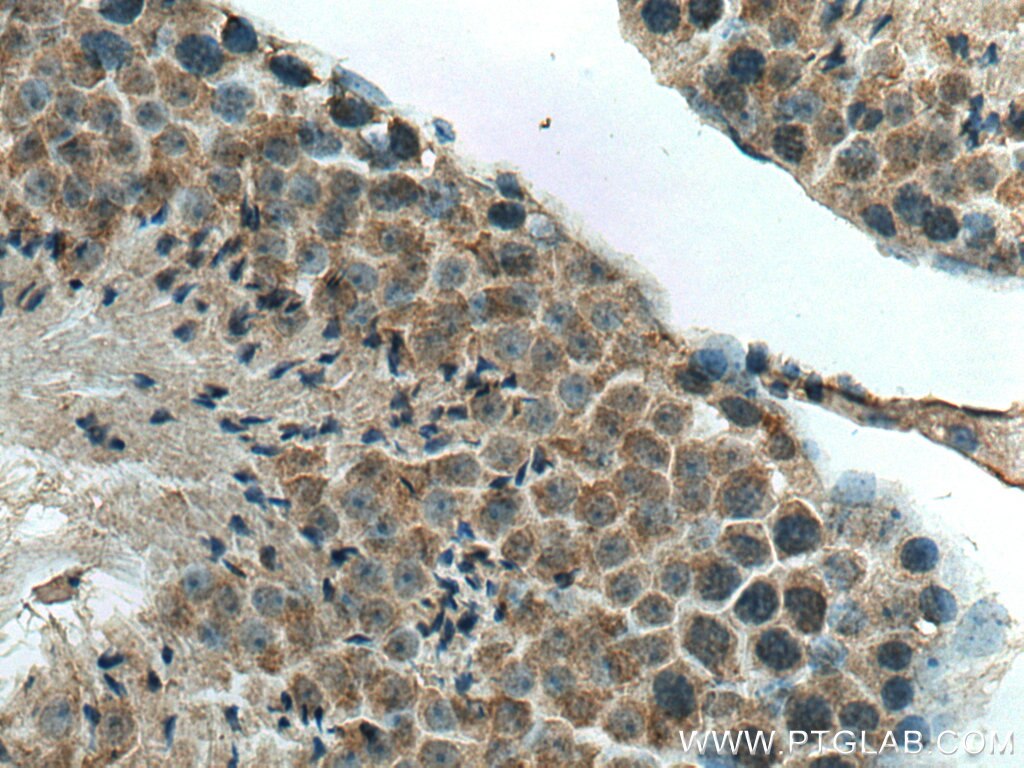 Immunohistochemistry (IHC) staining of mouse testis tissue using DNAJC18 Polyclonal antibody (25162-1-AP)
