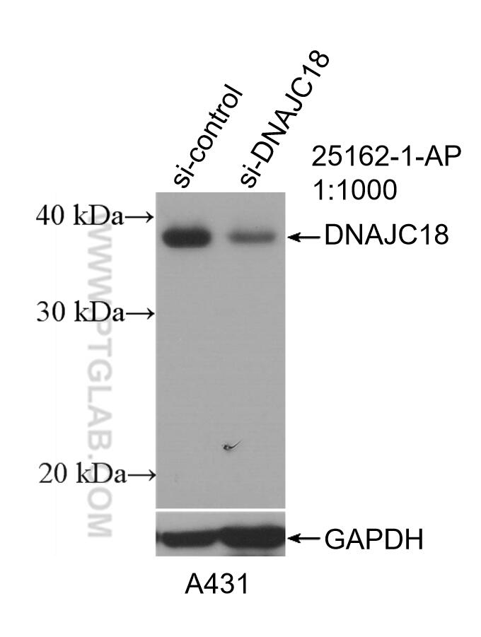 Western Blot (WB) analysis of A431 cells using DNAJC18 Polyclonal antibody (25162-1-AP)