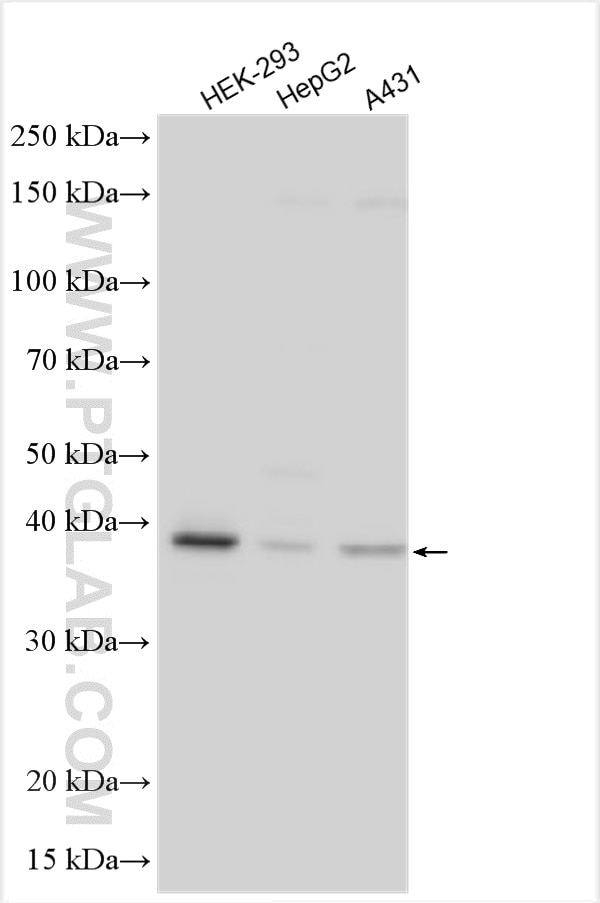 Western Blot (WB) analysis of various lysates using DNAJC18 Polyclonal antibody (25162-1-AP)