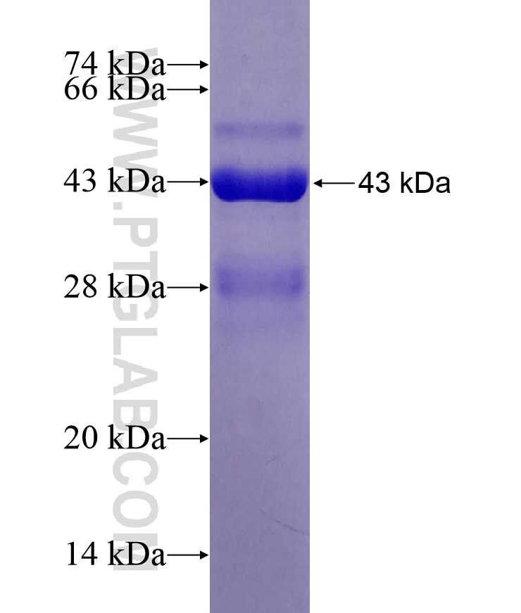 DNAJC18 fusion protein Ag18498 SDS-PAGE
