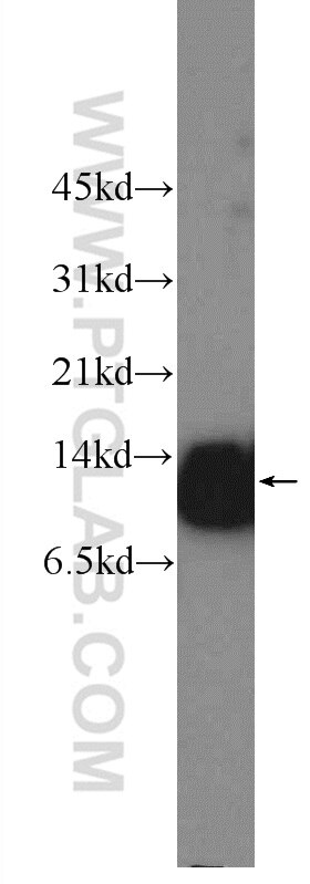 WB analysis of HeLa using 12096-1-AP