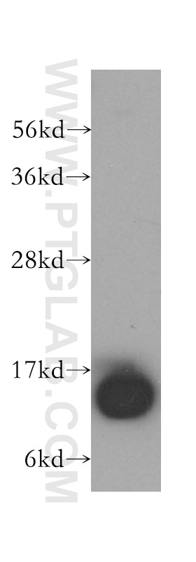 Western Blot (WB) analysis of HeLa cells using DNAJC19 Polyclonal antibody (12096-1-AP)