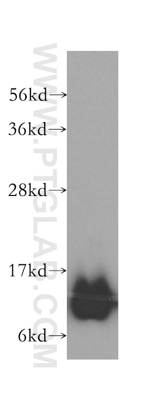Western Blot (WB) analysis of human brain tissue using DNAJC19 Polyclonal antibody (12096-1-AP)