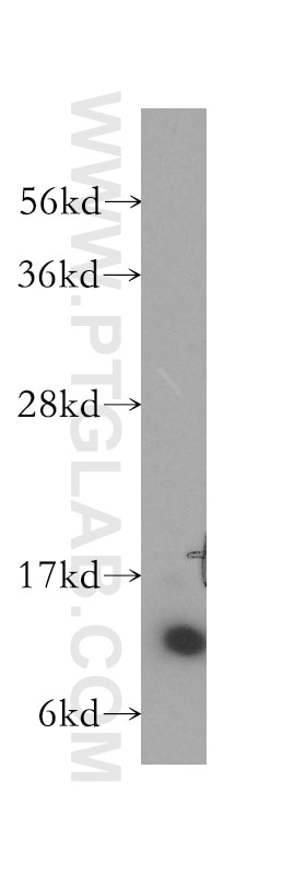 WB analysis of human lung using 12096-1-AP