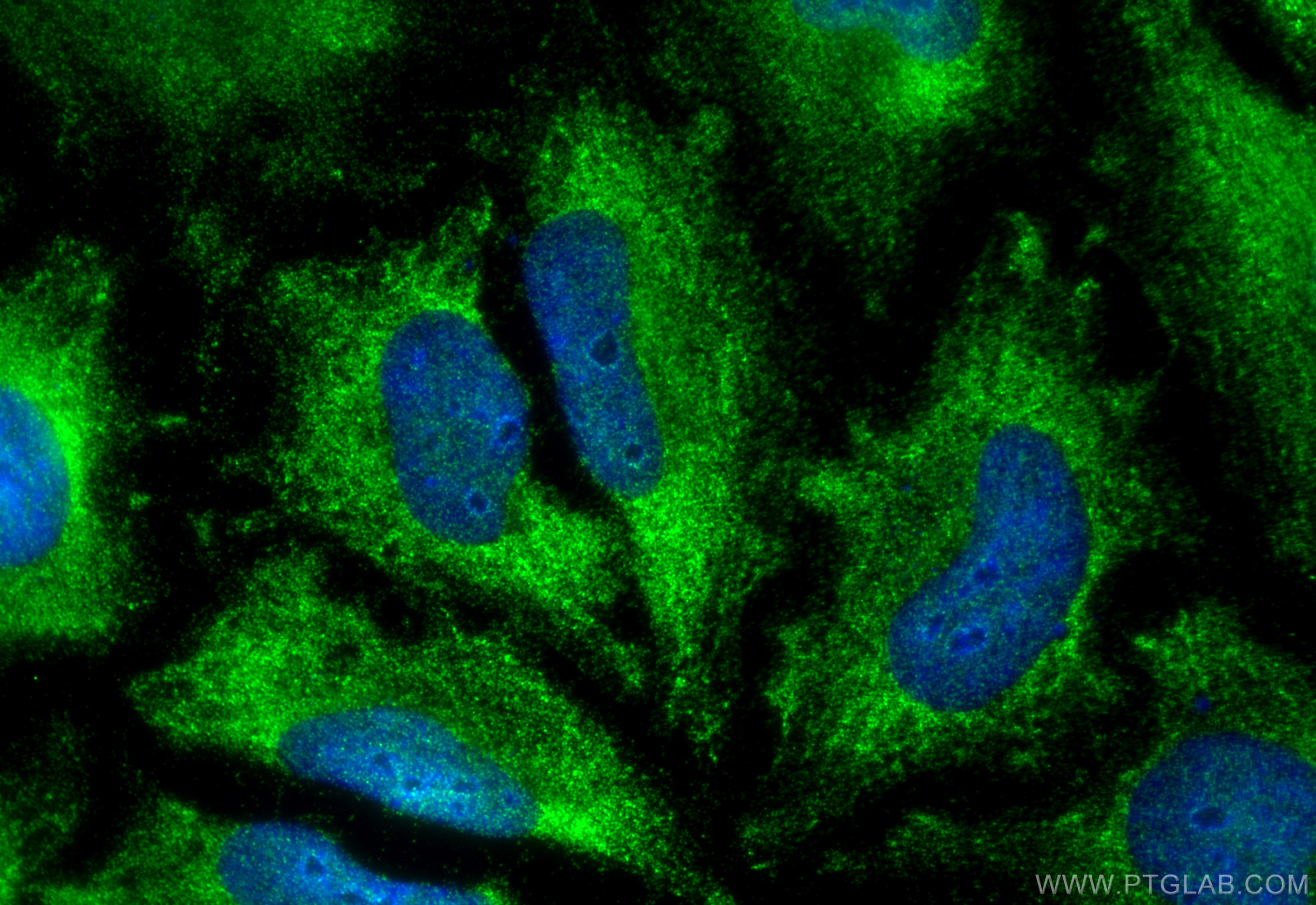 Immunofluorescence (IF) / fluorescent staining of HeLa cells using DNAJC2/MPP11 Polyclonal antibody (11971-1-AP)