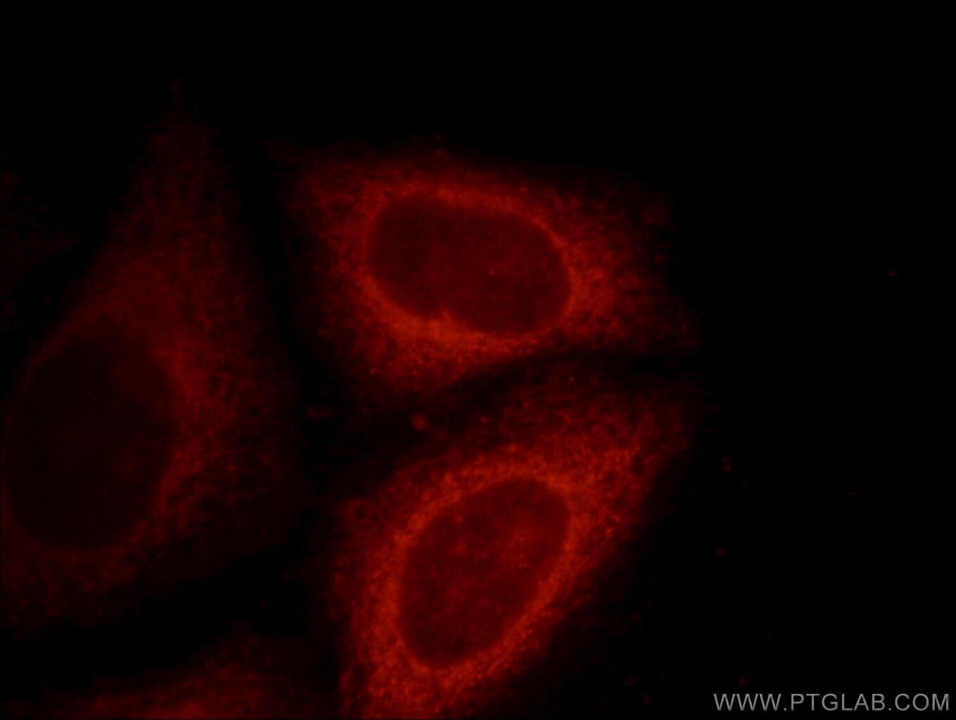 IF Staining of HepG2 using 11971-1-AP