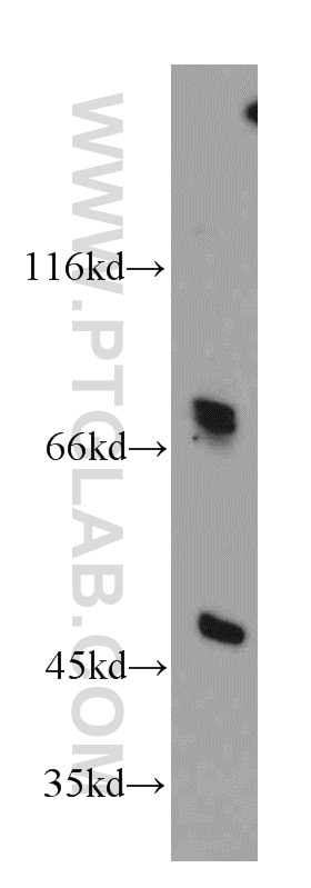 Western Blot (WB) analysis of HepG2 cells using DNAJC2/MPP11 Polyclonal antibody (11971-1-AP)