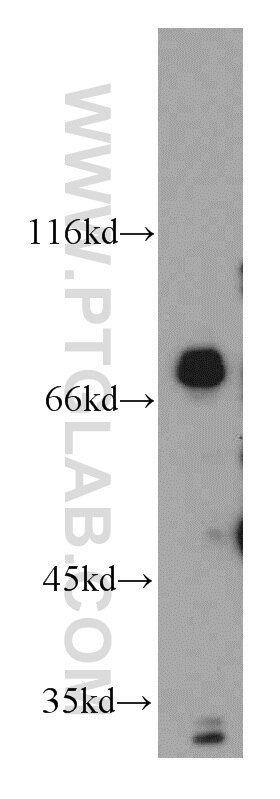 Western Blot (WB) analysis of K-562 cells using DNAJC2/MPP11 Polyclonal antibody (11971-1-AP)