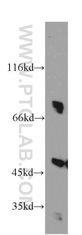 Western Blot (WB) analysis of HeLa cells using DNAJC2/MPP11 Polyclonal antibody (11971-1-AP)