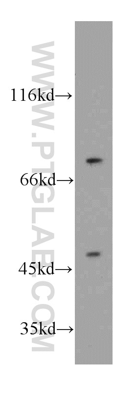 Western Blot (WB) analysis of PC-3 cells using DNAJC2/MPP11 Polyclonal antibody (11971-1-AP)