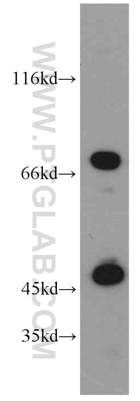 DNAJC2/MPP11