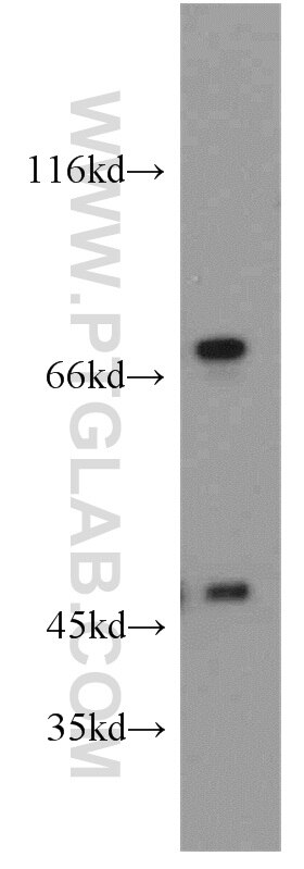 Western Blot (WB) analysis of HeLa cells using DNAJC2/MPP11 Polyclonal antibody (11971-1-AP)