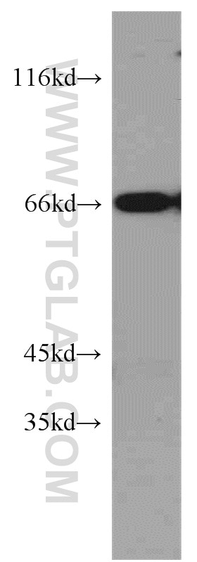 Western Blot (WB) analysis of HepG2 cells using DNAJC2/MPP11 Polyclonal antibody (11971-1-AP)