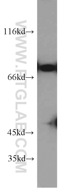 Western Blot (WB) analysis of HEK-293 cells using DNAJC2/MPP11 Polyclonal antibody (11971-1-AP)