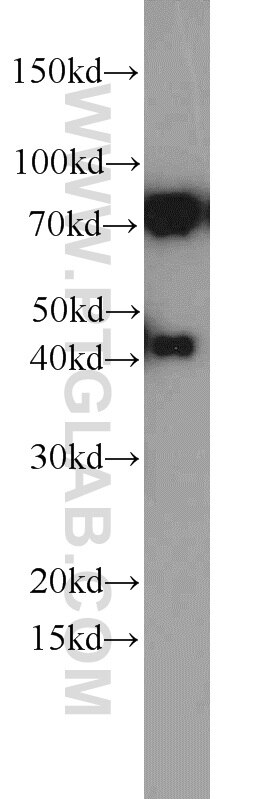 Western Blot (WB) analysis of PC-3 cells using DNAJC2/MPP11 Polyclonal antibody (11971-1-AP)