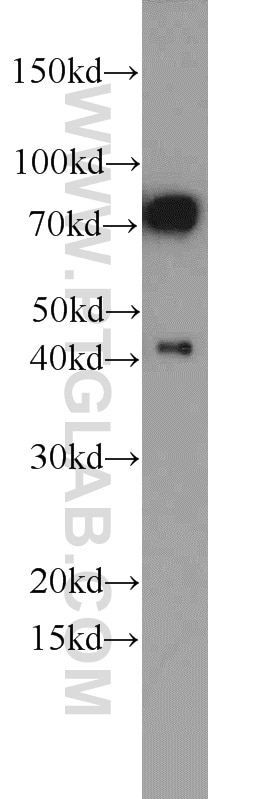 Western Blot (WB) analysis of PC-3 cells using DNAJC2/MPP11 Polyclonal antibody (11971-1-AP)