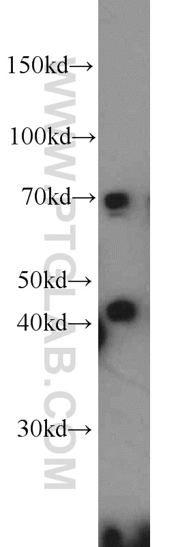 Western Blot (WB) analysis of HeLa cells using DNAJC2/MPP11 Polyclonal antibody (11971-1-AP)