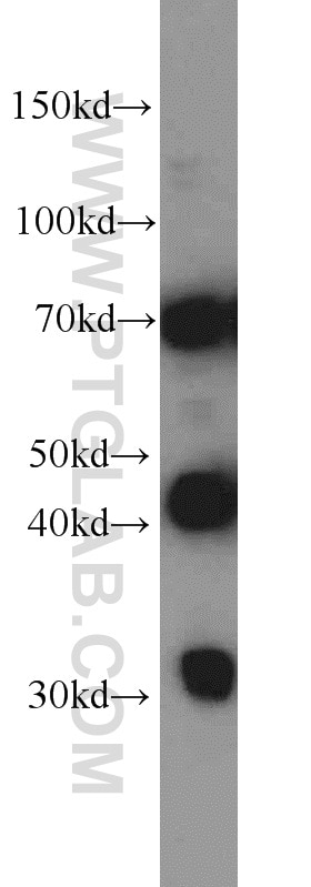 Western Blot (WB) analysis of HeLa cells using DNAJC2/MPP11 Polyclonal antibody (11971-1-AP)