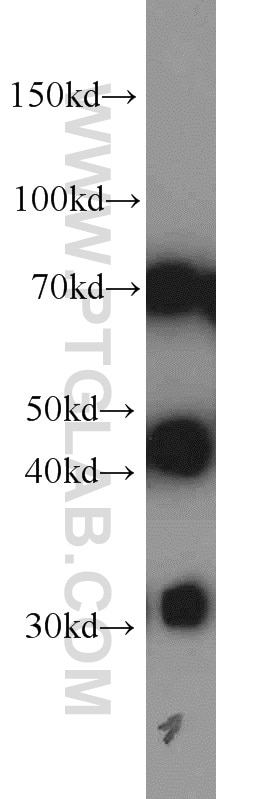 Western Blot (WB) analysis of HeLa cells using DNAJC2/MPP11 Polyclonal antibody (11971-1-AP)