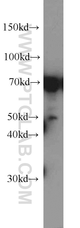 WB analysis of HeLa using 11971-1-AP